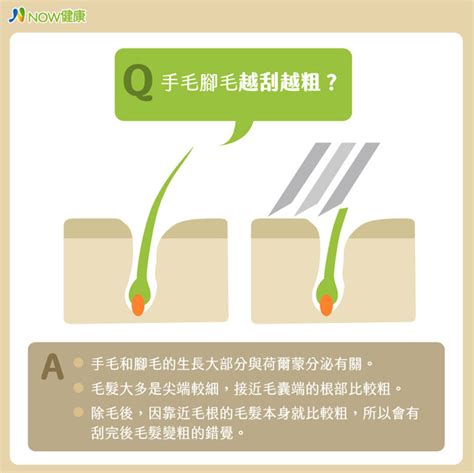 膝蓋長毛|腳毛會愈刮愈粗？身體 5 處除毛，醫師建議這樣處理